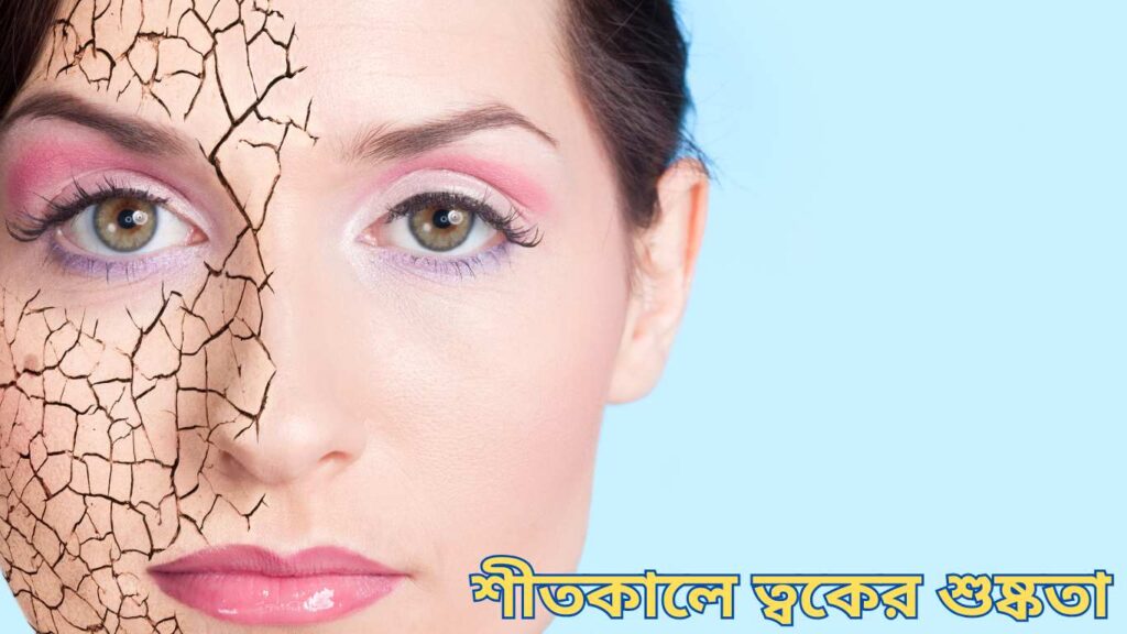 শীতে শুষ্ক ত্বকের সমস্যায় ভুগছেন?