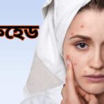 ব্ল্যাকহেড দূর করুন ঘরে বসেই